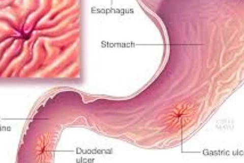 pathogenic bacteria that invade the stomach or intestines