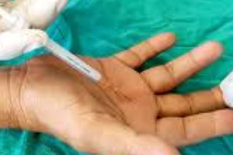 🤲 Trigger Finger & the Role of Voluntary Fasting: A Natural Healing Approach