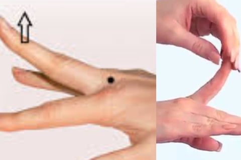 🤲 Trigger Finger & the Role of Voluntary Fasting: A Natural Healing Approach