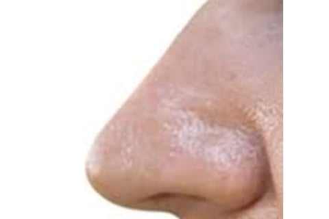 _🧠👃 The Nose Knows Exploring the Strange Smell Linked to Cancer