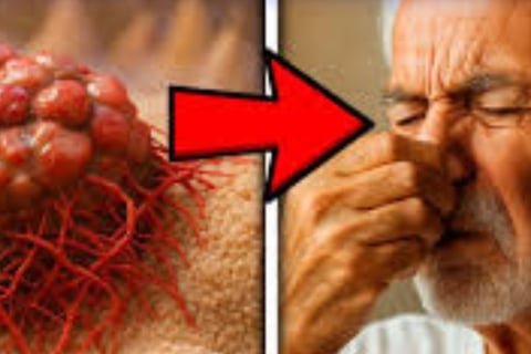 _🧠👃 The Nose Knows Exploring the Strange Smell Linked to Cancer