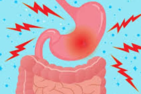 Emesis and Upper Digestive Tract Blockages