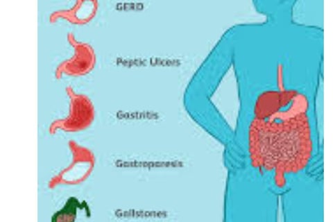 Emesis and Upper Digestive Tract Blockages
