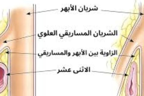Emesis and Upper Digestive Tract Blockages