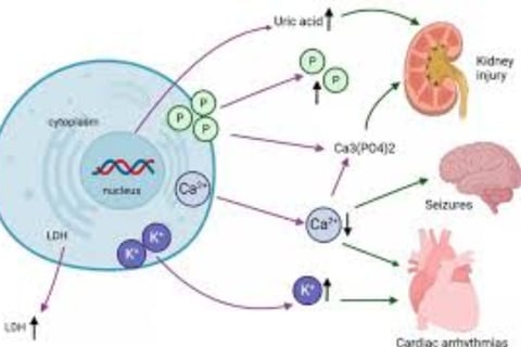 Fasting and Tumor Lysis Syndrome