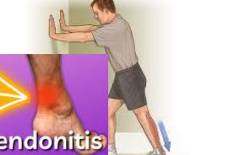 achilles tendon