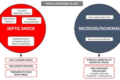 Adjunctive remedies Necrotizing fasciitis2