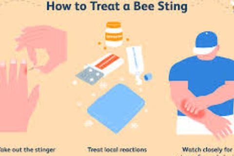 Bee Therapy the Benefits and Uses of Bee Venom (4)