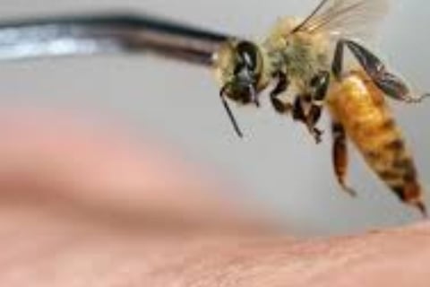 Bee Therapy the Benefits and Uses of Bee Venom (5)