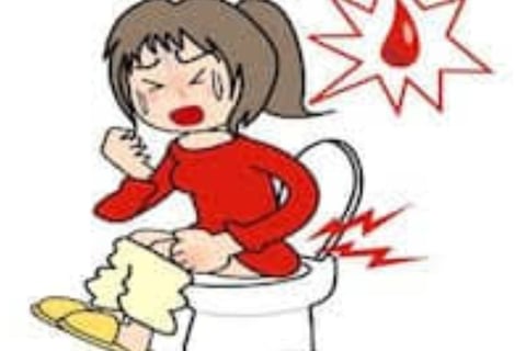 Bleeding Per Anus And Only Free Treatment