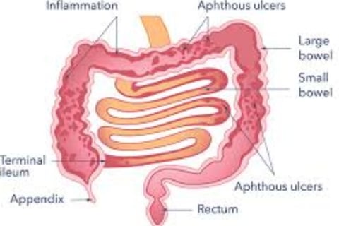 Bleeding Per Anus And Only Free Treatment (4)