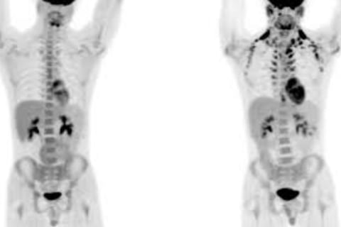 Brown Fat: Energy, Cold, Fasting, and Diseases