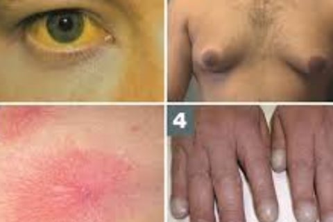 causes and symptoms liver skin