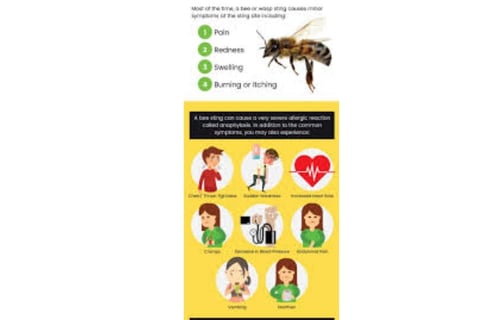 bee sting symptoms 