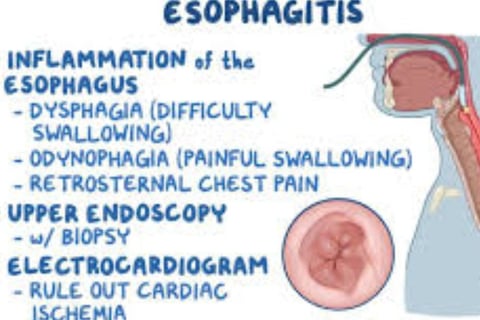 esophagitis