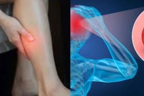 💧🩺 Why doesn’t dehydration during voluntary fasting lead to dangerous blood clots? Discover how th
