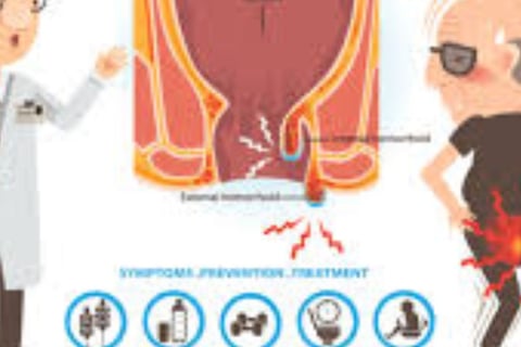FAQs Natural Remedies for Anal Fissures and Fistulas Start with Honey and Fasting