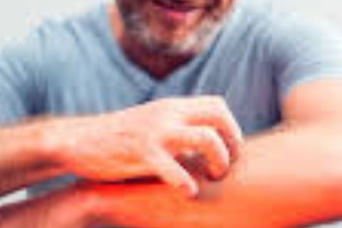 Fasting for Skin Allergies, Itching, and Pruritus