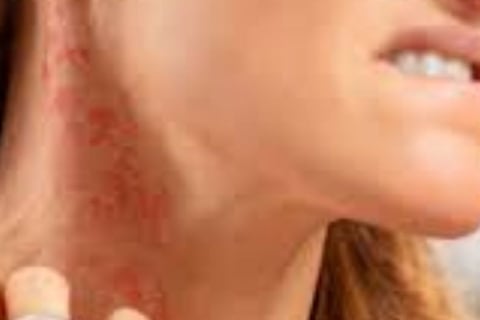Fasting For Skin Allergies Itching & Pruritus
