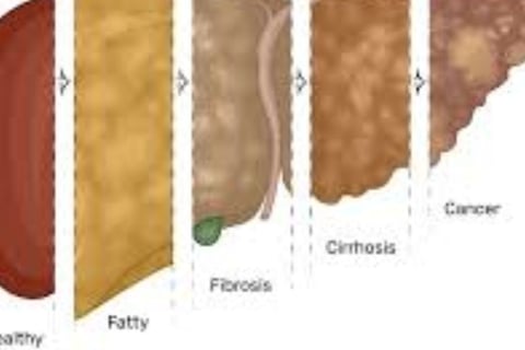 honey good for liver repair inflammation cirrhosis