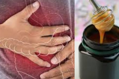 How to Administer Manuka Honey for Digestive Issues (3)