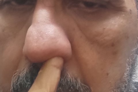 application of honey to the nose