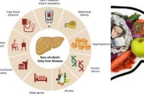 genetic causes of fatty liver disease