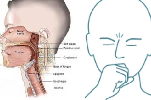 URTI Dr Hassan Al Warraqi Way of Treating Infection