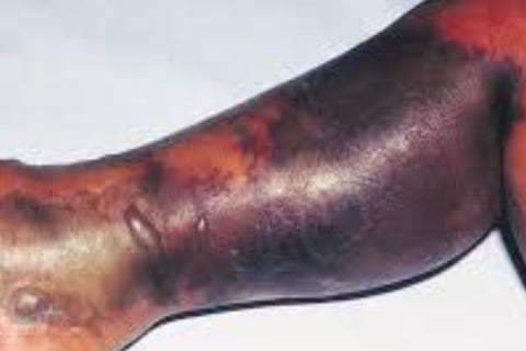 https://www.h-k-e-m.com/belt-of-fire-shingles-strange-management