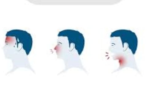 URTI Dr Hassan Al Warraqi Way of Treating Infection