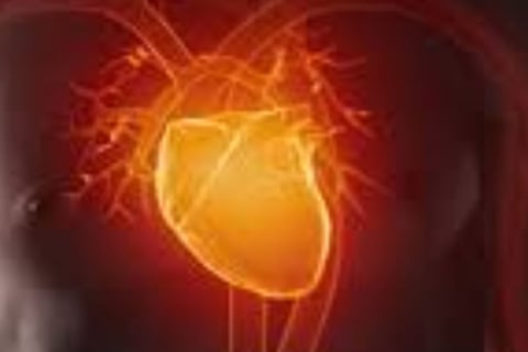 Voluntary Islamic Fasting for Arrhythmia