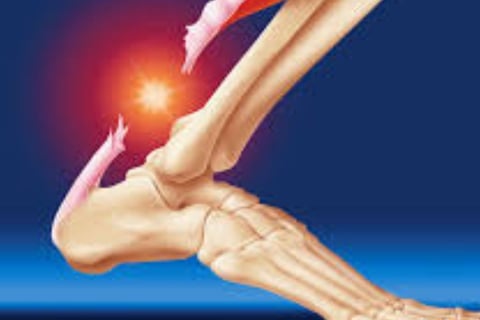 achilles tendon