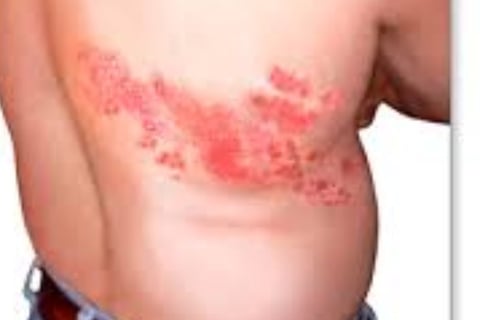 https://www.h-k-e-m.com/belt-of-fire-shingles-strange-management