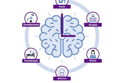 time is brain