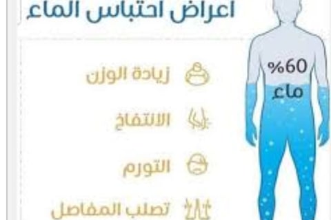 مرض الاستسقاء في البطن