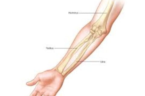 arm fractures