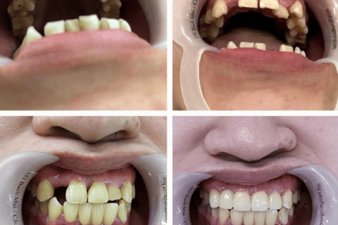 khách hàng niềng invisdental