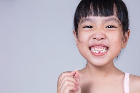 trẻ em niềng răng