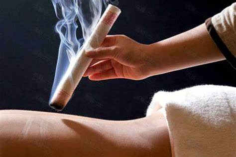 Moxibustion