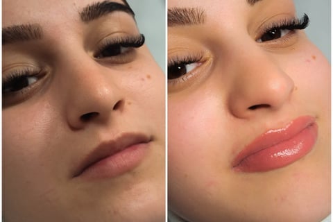 Eine Frau, die ihre Lippen von einer professionellen Kosmetikerin mit Permanent Make-up 