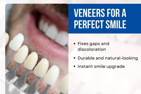 Boring Digital Marketing Idea for Veneers