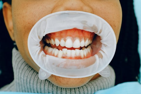 how to get rid of cavity smell