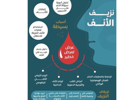 اسباب النزف كيف تدير نزيف الانف :علاج نزيف الانف الخلفي بالعسل والمضمضة