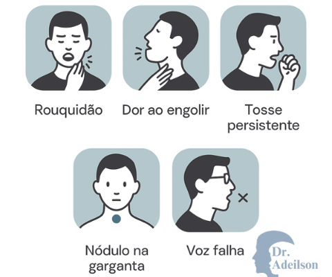 Sintomas/sinais que deveria se fazer um exame de videolaringoscopia