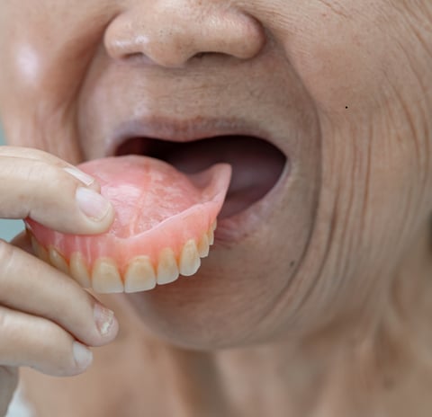 Full and partial dentures offering customized dental care to replace missing teeth and restore oral