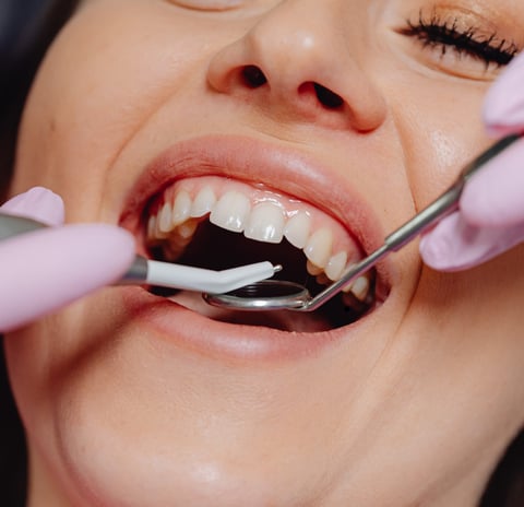 Dental surgeon performing gum surgery to treat gum disease and restore healthy gum tissue