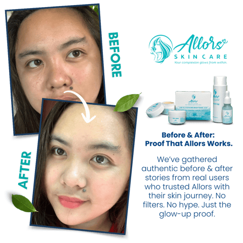 Before-and-after skincare results with Allors, featuring products and a tagline on real user experiences.
