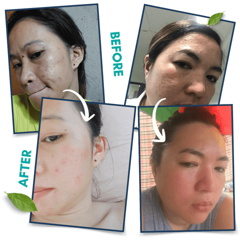 Collage of four images showing side-by-side skincare results after using Allors Skincare products.
