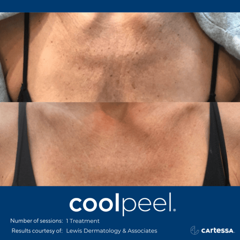 a woman with a very large chest and a very small chest