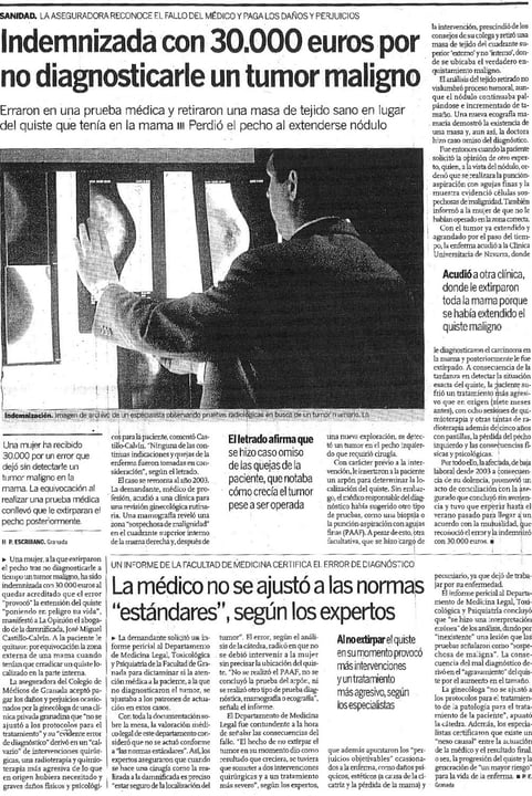 cáncer de mama tumor maligno en el pecho